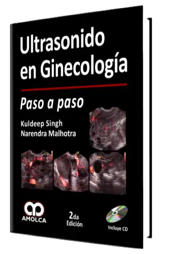 Ultrasonido en Ginecología Paso a paso. 2 edición