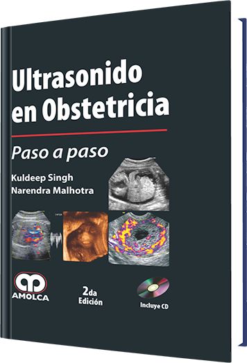 Ultrasonido en Obstetricia Paso a paso. 2 Edición