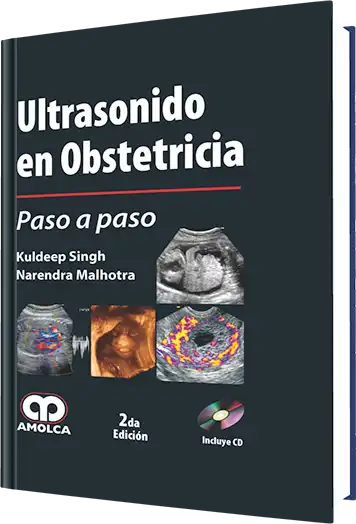 Ultrasonido en Obstetricia Paso a paso. 2 Edición