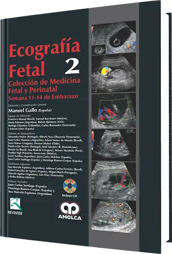 Ecografía Fetal Semana 11-14 de Embarazo. Volumen 2