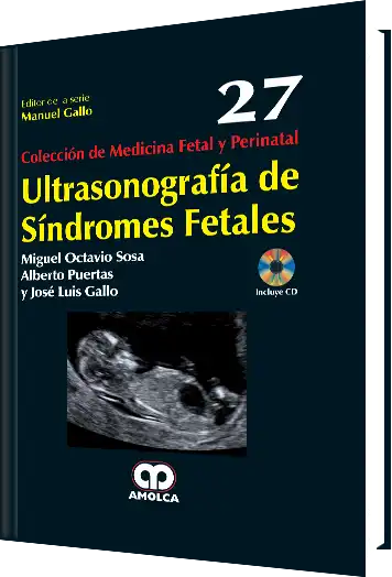Ultrasonografía de Síndromes Fetales. Volumen 27