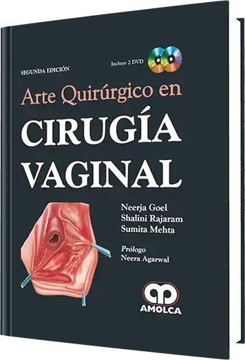 Arte Quirúrgico en Cirugía Vaginal 2 edición