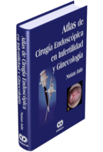 Atlas de Cirugía Endoscópica en Infertilidad y Ginecología