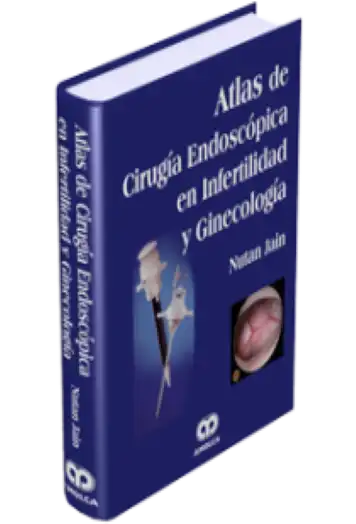 Atlas de Cirugía Endoscópica en Infertilidad y Ginecología