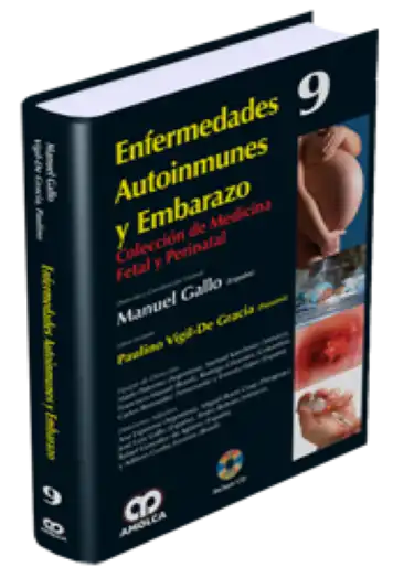 Enfermedades Autoinmunes y Embarazo. Volumen 9