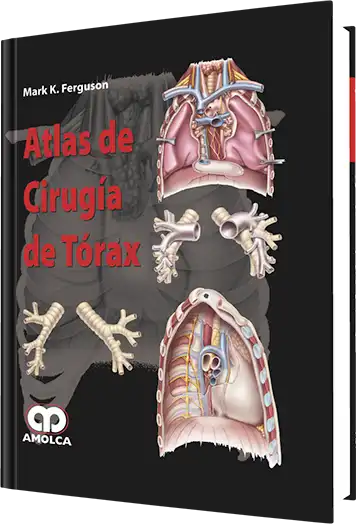 Atlas de Cirugía de Tórax