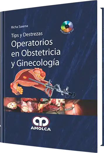 Tips y Destrezas Operatorios en Obstetricia y Ginecología