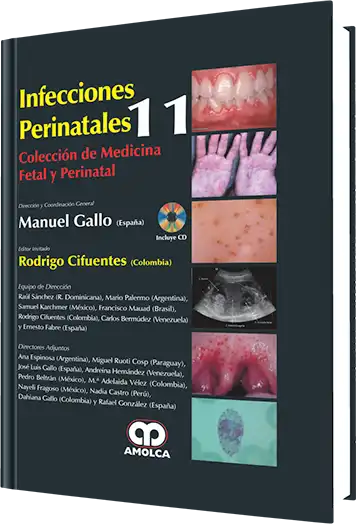 Infecciones Perinatales. Volumen 11