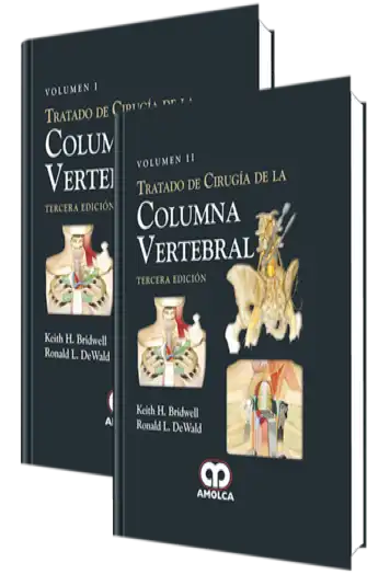 Tratado de Cirugía de la Columna Vertebral. 3 Edición