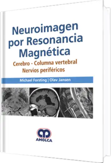 Neuroimagen por Resonancia Magnética