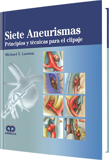 Siete Aneurismas