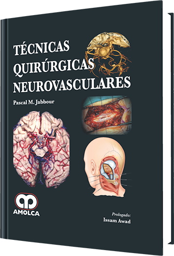 Técnicas Quirúrgicas Neurovasculares