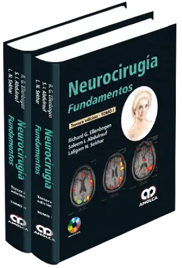 Neurocirugía Fundamentos. 3 Edición