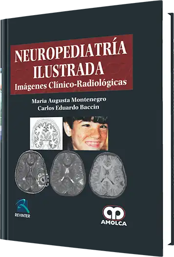 Neuropediatría Ilustrada