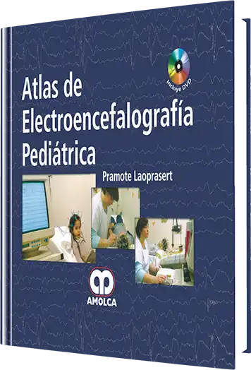 Atlas de Electroencefalografía Pediátrica