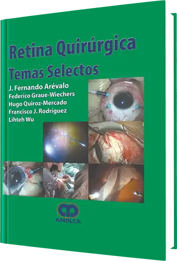 Retina Quirúrgica