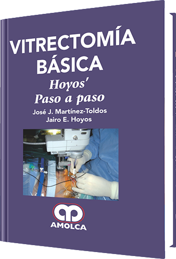 Vitrectomía Básica