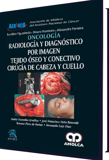 Oncología - Radiología y Diagnóstico por Imagen . Tejido Óseo y Conectivo Cirugía de Cabeza y Cuello
