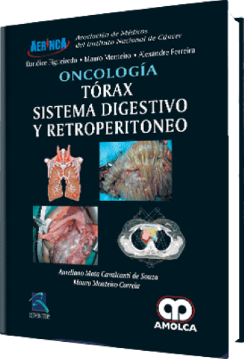 Oncología. Tórax, Sistema Digestivo y Retroperitoneo