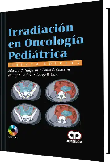 Irradiación en Oncología Pediátrica. 5 Edición