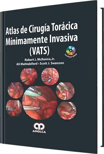 Atlas de Cirugía Torácica Mínimamente Invasiva (VATS)