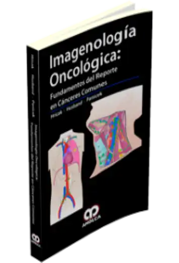 Imagenología Oncológica: Fundamentos del Reporte en Cáncer es Comunes