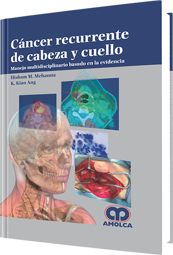 Cáncer Recurrente de Cabeza y Cuello