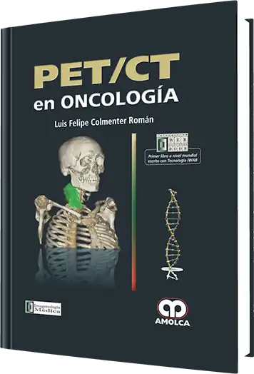 PET / CT en Oncología