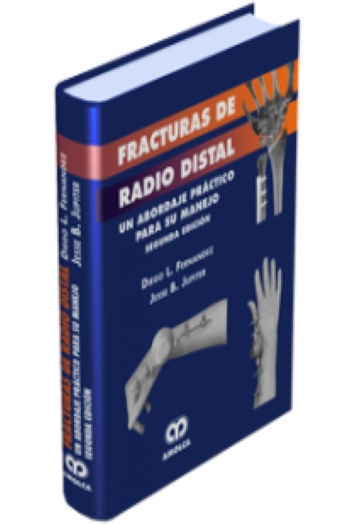 Fracturas de Radio Distal. 2 Edición