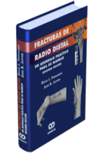 Fracturas de Radio Distal. 2 edición