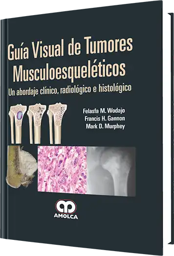 Guía Visual de Tumores Musculoesqueléticos