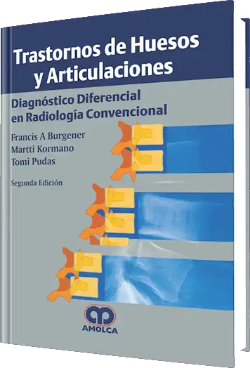Trastornos de Huesos y Articulaciones. 2 edición