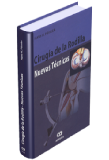 Cirugía de la Rodilla