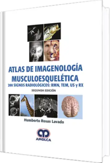 Atlas de Imagenología Musculoesquelética 2 edición