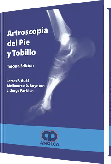 Artroscopia del Pie y Tobillo. 3 edición