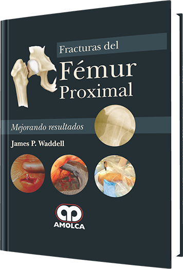 Fracturas del Fémur Proximal