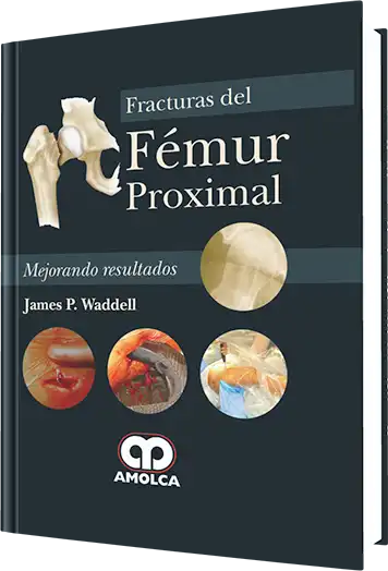 Fracturas del Fémur Proximal