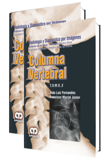 Radiología y Diagnóstico por Imágenes Columna Vertebral