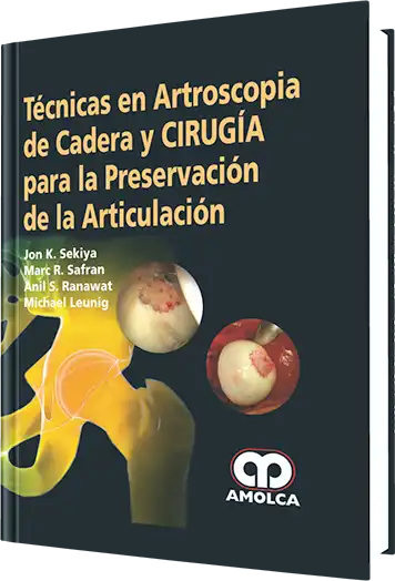 Técnicas en Artroscopia de Cadera y Cirugía para la Preservación de la Articulación