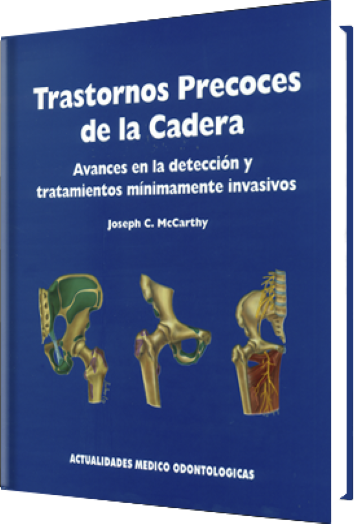 Trastornos Precoces de la Cadera