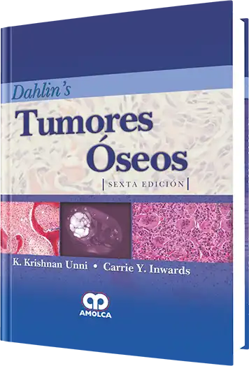 Tumores Óseos 6 edición