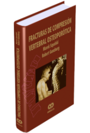 Fracturas de Compresión Vertebral Osteoporótica