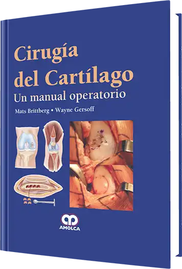 Cirugía del Cartílago. Un Manual Operatorio