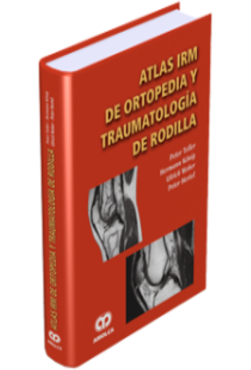 Atlas IRM de Ortopedia y Traumatología de Rodilla