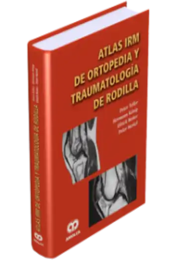 Atlas IRM de Ortopedia y Traumatología de Rodilla