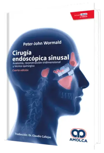 Cirugía Endoscópica Sinusal.  4 edición