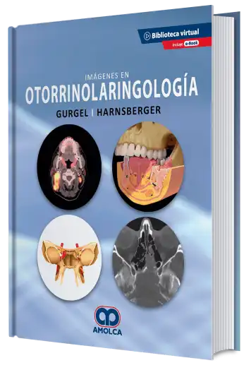 Imágenes en Otorrinolaringología