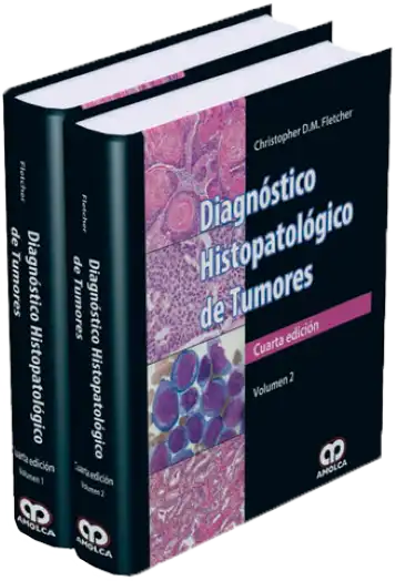 Diagnóstico Histopatológico de Tumores. 4 edición