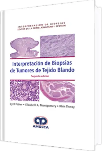 Interpretación de Biopsias de Tumores del Tejido Blando 2 edición