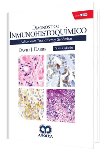 Diagnóstico Inmunohistoquímico Aplicaciones Teranósticas y Genómicas 5 edición